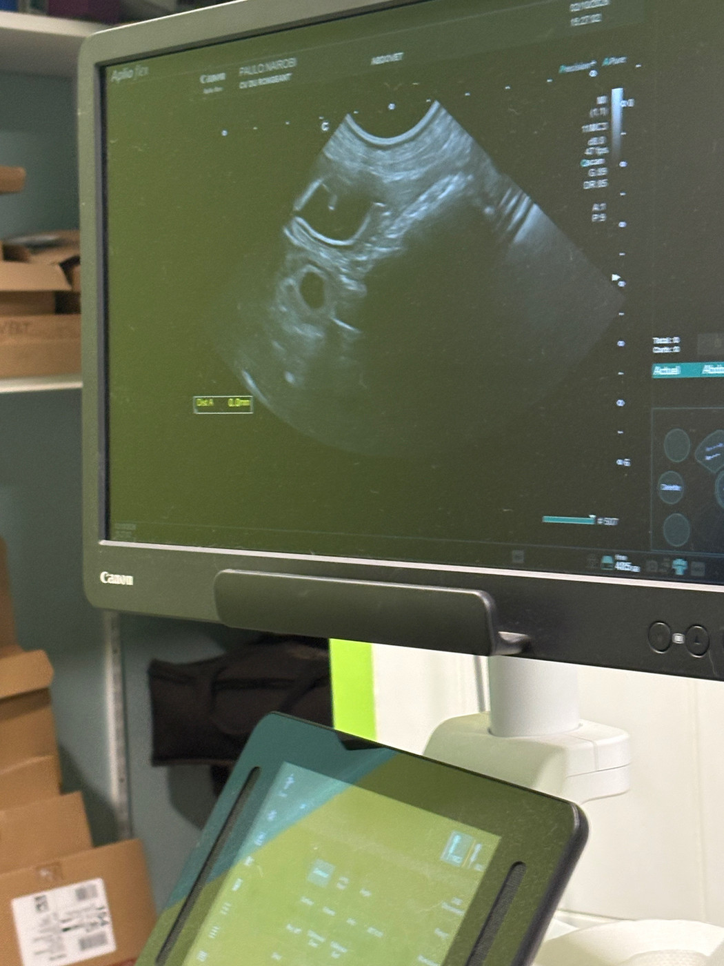 Confirmation de gestation